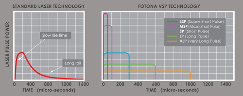 VSP Variable Square Pulse Technology