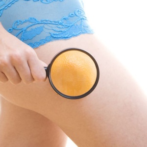 OrangeLase